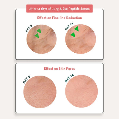 Sonäge A-Eye Peptide Serum™