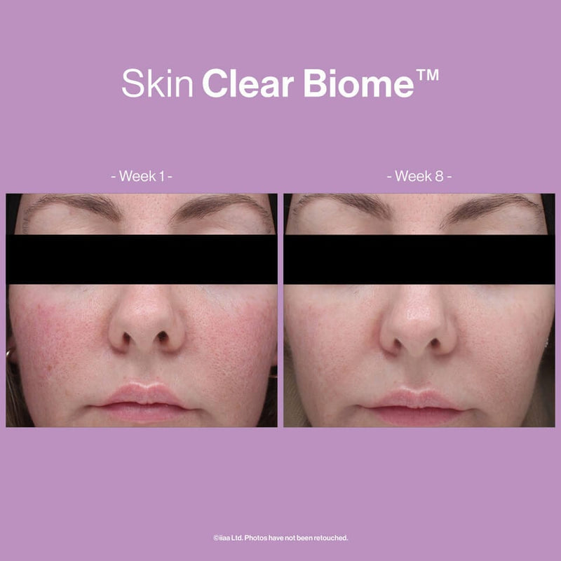 ANP Skin Clear Biome™ 60caps